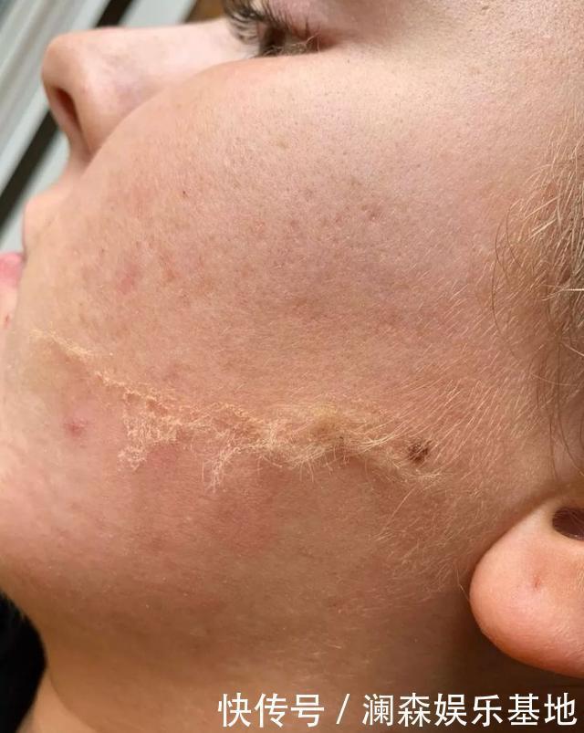 拍照|除了拍照磨皮还不够,欧美女生迷上了人工磨皮