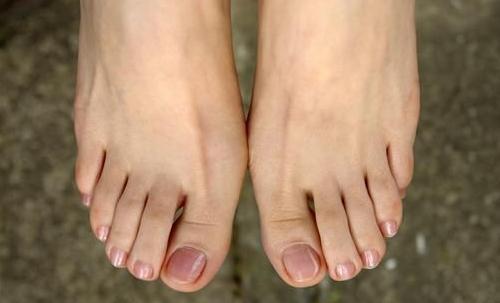 脚趾|“肾”好不好看脚,若脚上没有以下4种情况,说明你的肾很健康