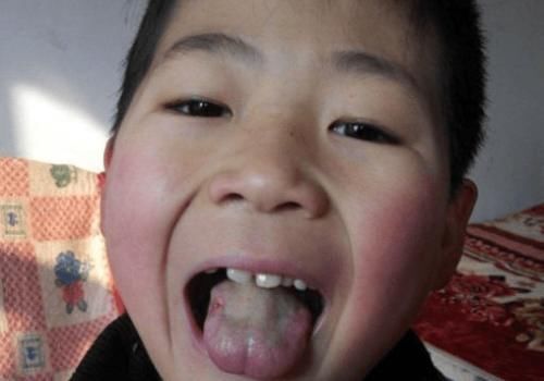 父母|这3种行为或正“偷走”孩子身高,医生:父母无知耽误孩子!