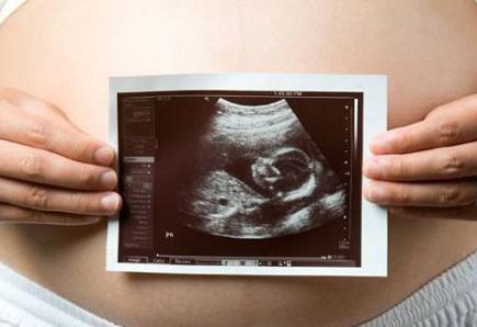 孕囊|孕期反应看男女?过来人说出“大实话”,告诉你什么才是最准确的