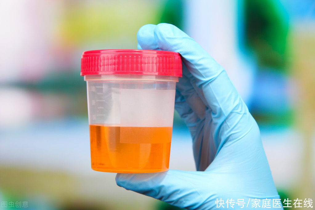 细菌病毒|喝水会影响体检结果？其实不是所有项目都要空腹的，尤其是这几个