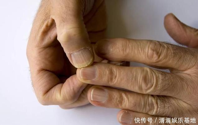 手上出现4个变化,说明肝在求救,多做2事,肝脏不会硬化