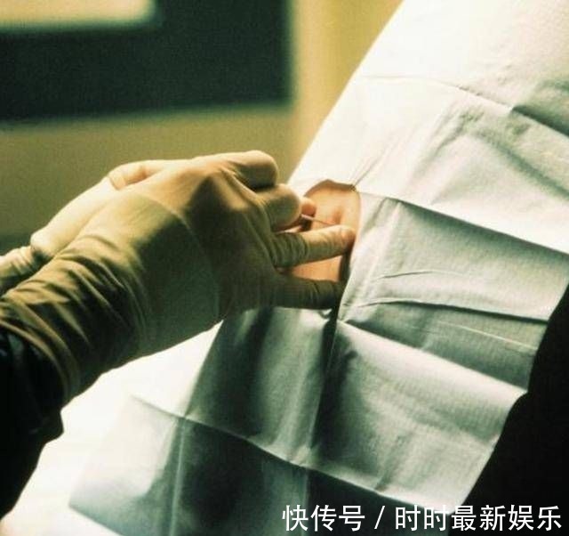 顺产|剖腹产就是打一针睡一觉看看这根腰椎针的长度,还仅仅是个开头