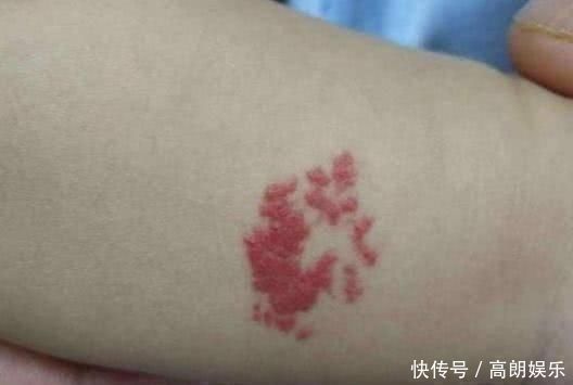 垃圾食品|产妇生出“花脸娃娃”，宝妈悔恨得直掉眼泪，医生看你还嘴馋不