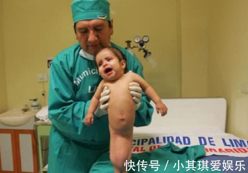 名人传|女童出生便患美人鱼症,喜欢呆在水里,用乐观打败缺陷