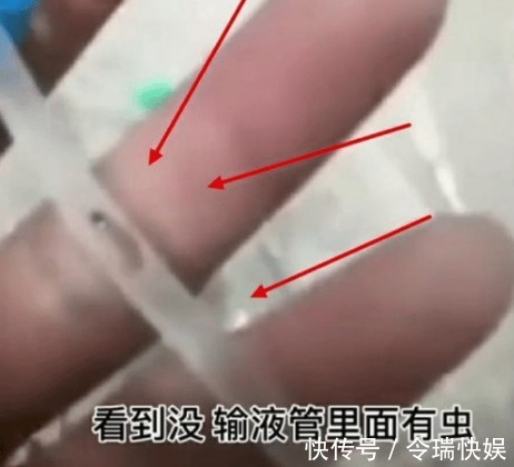 卫生|3岁幼童输液,输液管里惊现虫子,爸爸都输进我娃身体里了