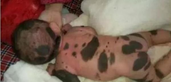 怀孕期间|怀孕的妈妈想生儿子,就吃下所谓的“转胎丸”,宝宝出生时悲剧了