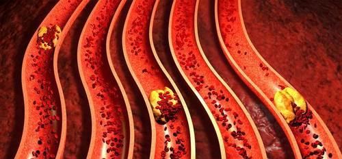 高脂蛋白血症|生花生和熟花生，哪个更营养？医生：5类人最好少碰，别不当回事