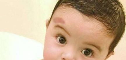 孕期|不想宝宝出生后有胎记？孕期尽量避开三点，或许有助于胎儿发育