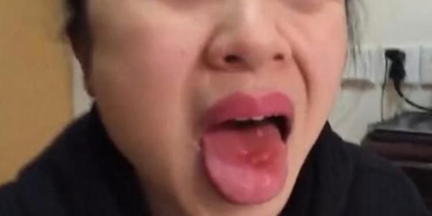 零食|女童舌头被“炸成筛子”,一元一包的“新奇零食”才是真“垃圾”