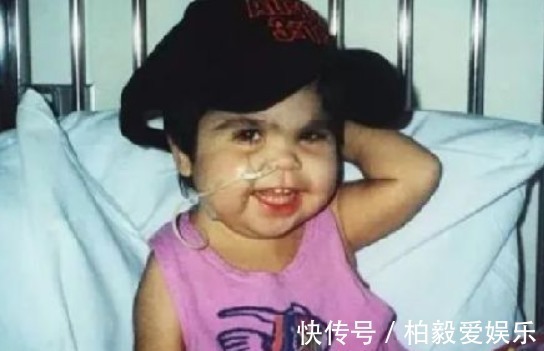 综合症|女童出生便患有美人鱼症,喜欢在水里的感觉,用乐观战胜缺陷