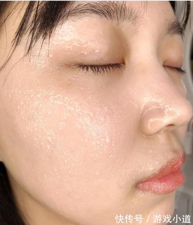 肌底液 为什么你的皮肤越护理越糙可能踩了这5个护肤误区,你中了几个!