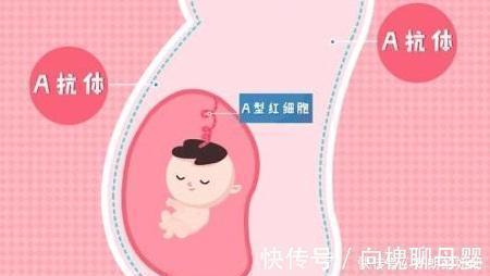 溶血病|这两种血型的孕妇, 头胎最好别流掉, 第一个宝宝对你很重要