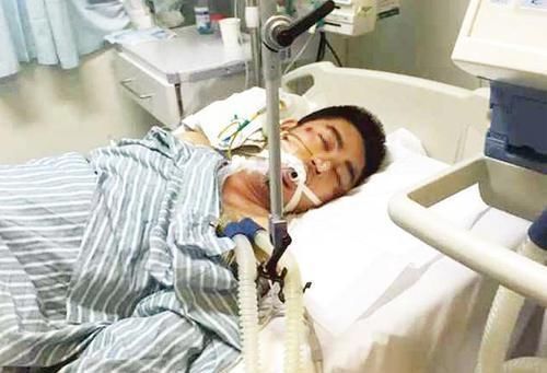 肝脏CT|肝癌是酒“泡”出来的?两个部位很臭,最好去检查一下肝脏CT