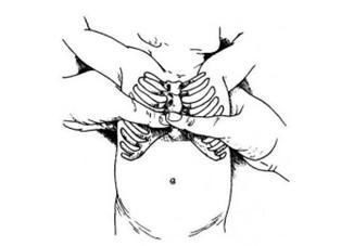 新生儿|宝宝出生后全身青紫,急救只用4分钟!这个方法得学!