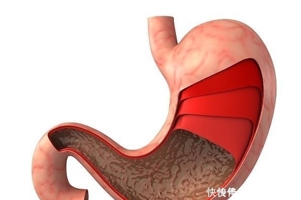 经常吃糯米，可能会给身体带来这3个“惊喜”，你了解了吗？