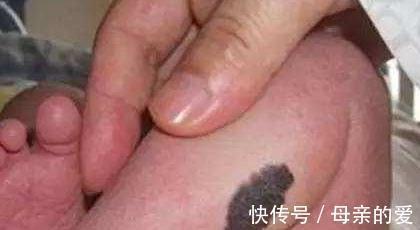 怀孕期间|怀孕期间孕妈坏脾气对胎儿有影响,莫等宝宝畸形才知错