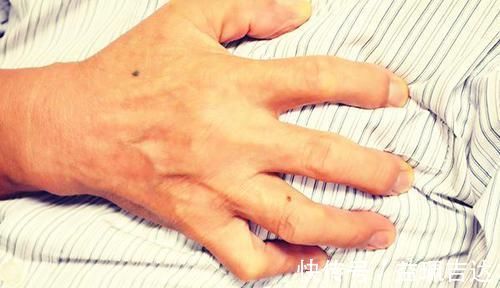 脑卒中|得了高血压，医生提议4个器官，要重点呵护，并不是白费事