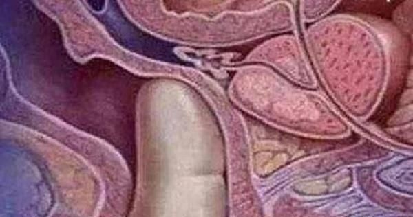 开十指|产前内检很尴尬,这项检查能取消吗听听医生怎么说