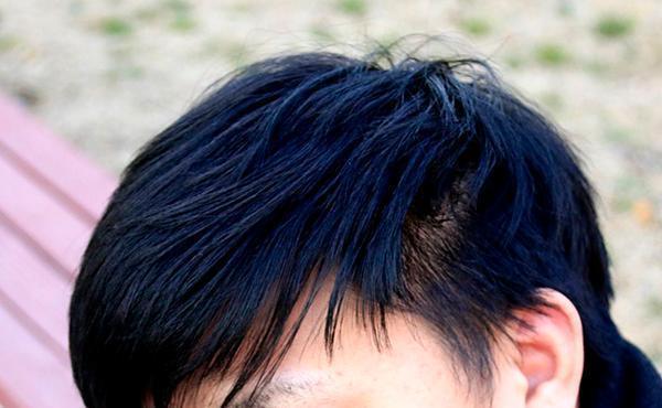 脾虚,人就废一半!长期脾虚的人,到底有什么