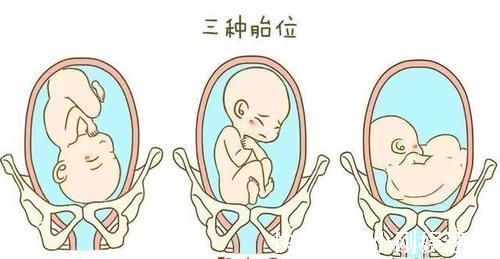 骨盆|孕期,怎样看懂胎位数据,早了解,早纠正