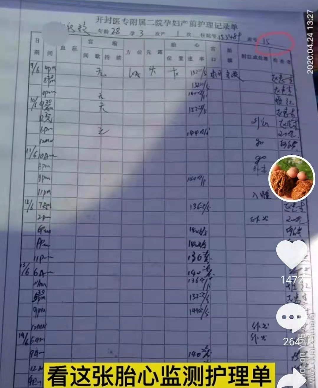 血常规|郑引19号开的医嘱,18号提前被送去检验,假医嘱暴露孩子出生日期