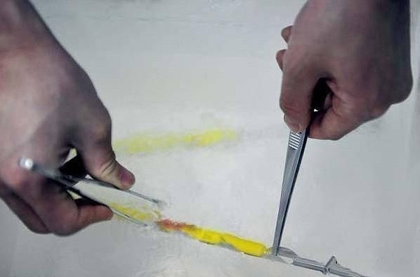 胚胎|揭秘试管婴儿全过程(附图),看完后心疼女性一万遍