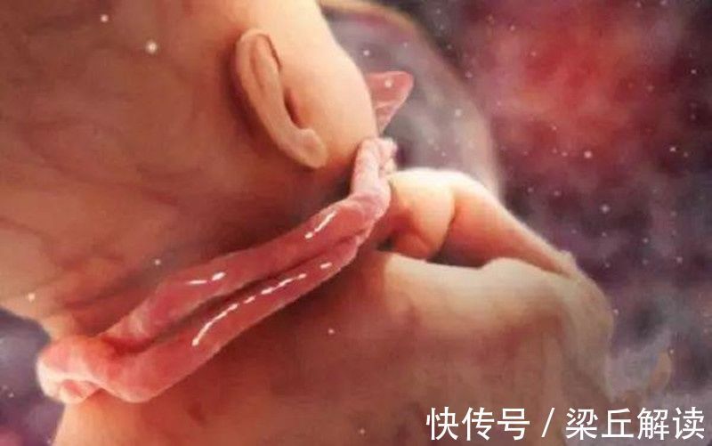 坏习惯|孕期常见的3种行为,容易诱发胎儿脐带绕颈,孕妈要注意改正