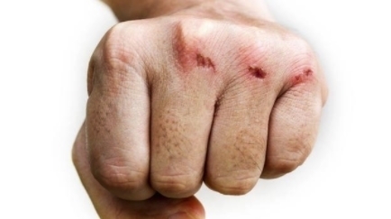 男女|不论男女,身体若出现4个信号,要小心血栓