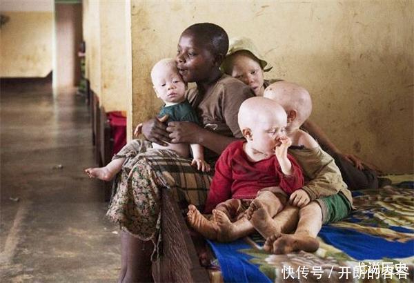 现实版“唐僧”,身处非洲,血液堪比黄金,被警察24小时保护