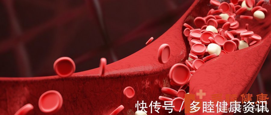 血液|日本血液净化-高血压患者需警惕4种现象