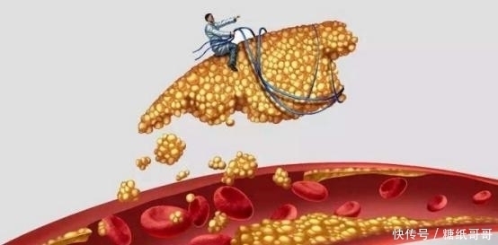 正常值|体检出高血脂怎么办?医生告诫:做好4点血脂值可以重回正常