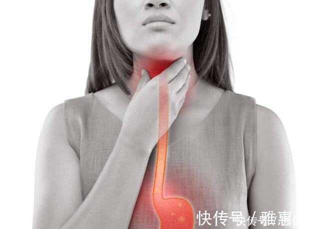 肾癌|打嗝是小事,若伴随这6个症状,应及时检查,谨防癌症风险