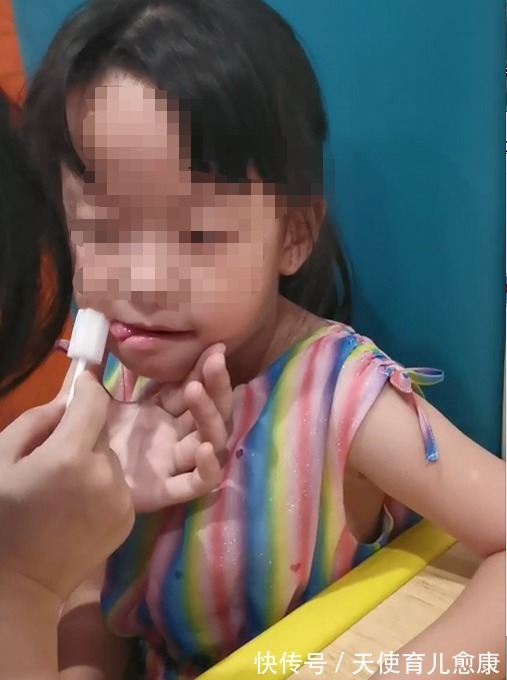 天使|天使锦囊：宝宝吐字不清、说话晚？这份口肌训练赶紧收藏吧