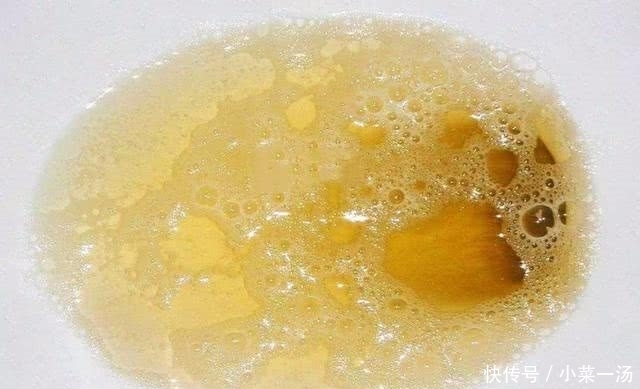 为何尿毒症越来越多?原因不外乎这“3个字”,别怪没人提醒!