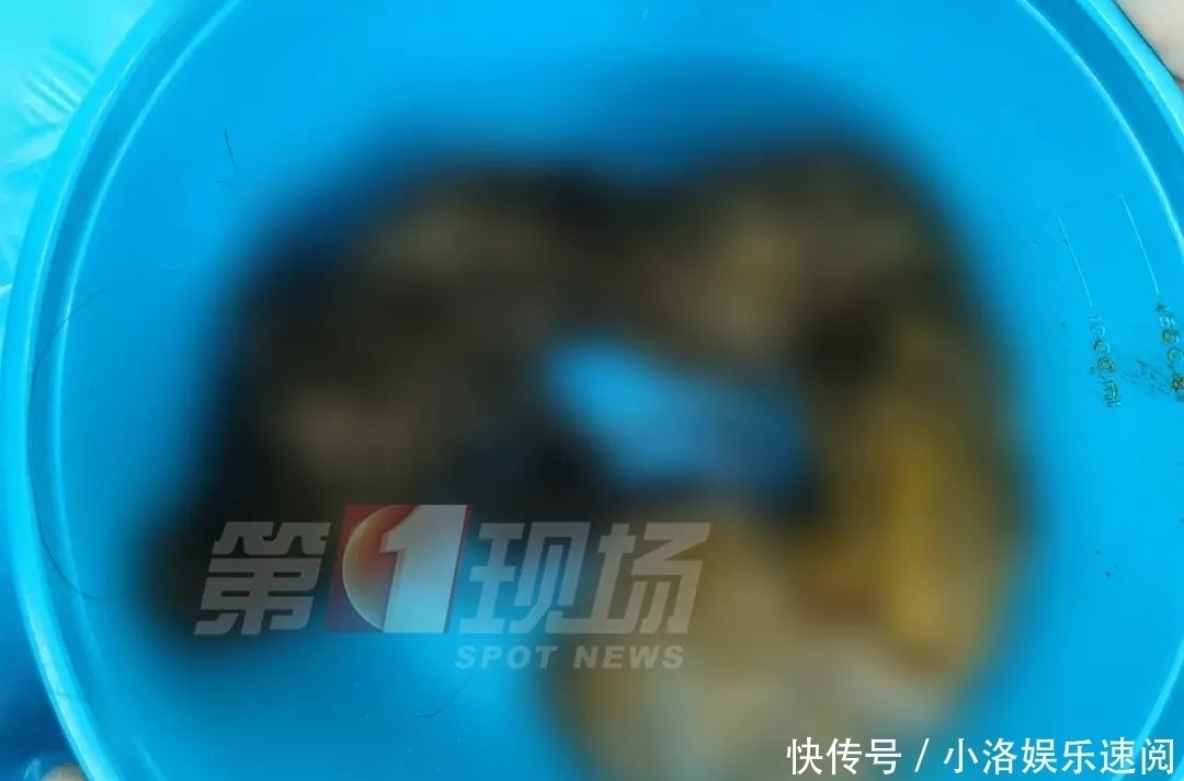 吃头发|头皮发麻14岁女孩胃里竟塞满…这个可怕习惯她保持了十年