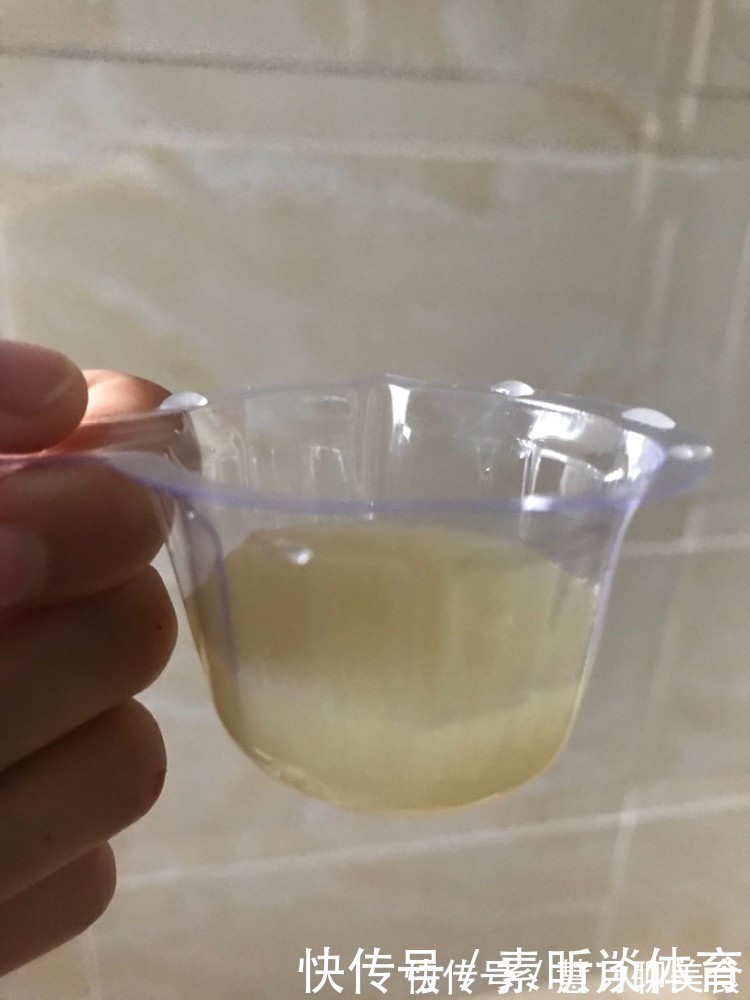 血糖|冬天起床后身体出现3个表现，说明血糖已经高了，糖尿病人要警惕