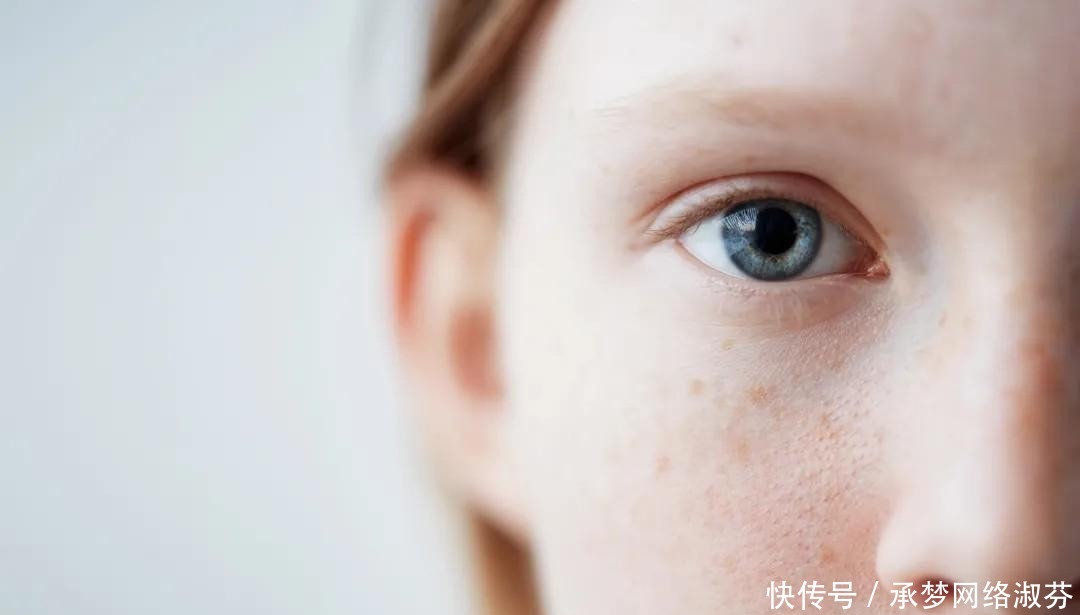 激素脸|为什么很多女生不护肤反而皮肤更好?坚持做这3件事,皮肤都不差