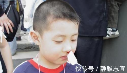 男孩|3岁男孩摔倒流鼻血，宝妈错误的处理后，医生也“无力回天”