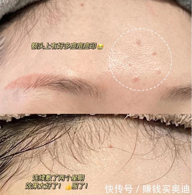 日常|常敷面膜除了日常补水,还有这几个好处!别不知道