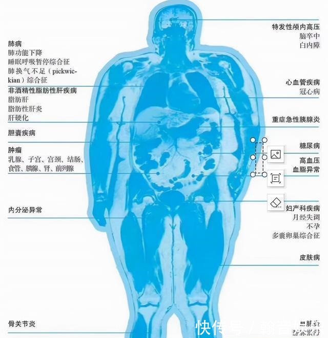 bmi|孕期到底要增重多少才合理？快来对照一下你超标没