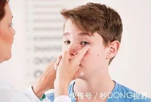 单纯性近视|近视600度以上和600度以下,区别仅仅是几个度数吗?