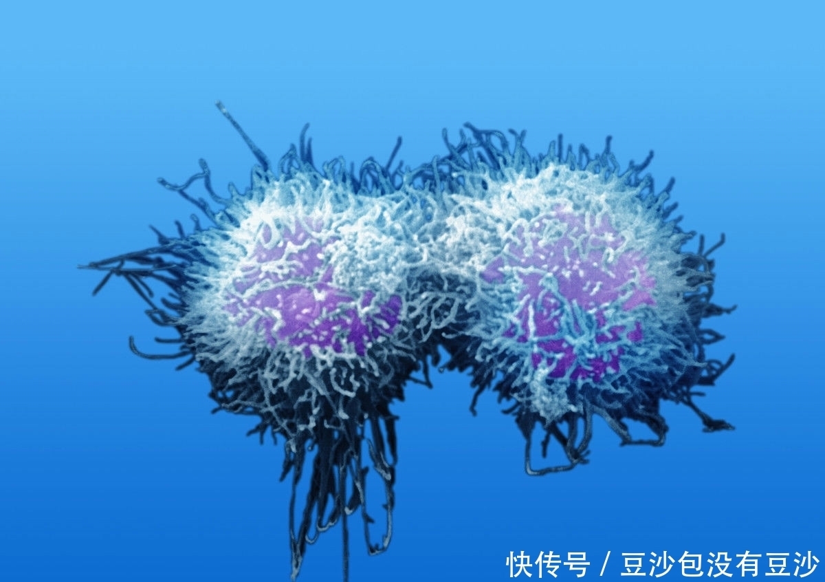  坏习惯|45岁男子确诊晚期口腔癌，不喝酒不抽烟，只因保持一种坏习惯