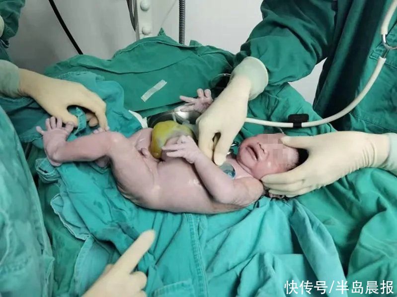有惊无险！新生宝宝肝脏＂挂＂在肚子外，幸好……这病男宝宝多发