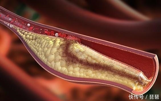 经常吃“腐乳”的人,会有什么变化?