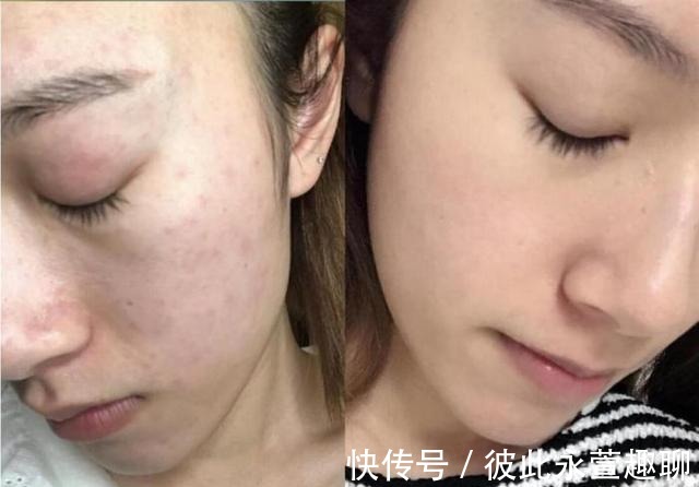 不起眼|我国有一款“不起眼”洁面皂,能控油除螨去黑头,却因价低被忽视