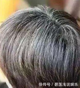 膀胱|白发与身体的关系，后悔现在才知道！附带防治的方法哦！快收藏