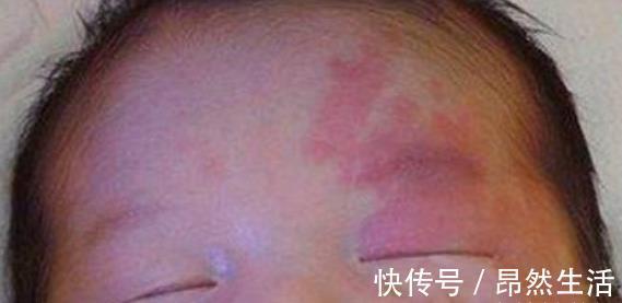 怀孕期间|胎儿自带“记号”,与孕妈错误行为有关,孕妈的放纵终由孩子买单