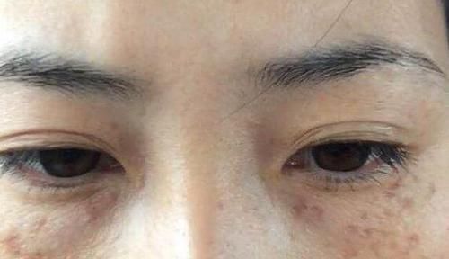 延缓衰老|脸上出现3个“表现”，可能是衰老“找上门”了，别不当回事