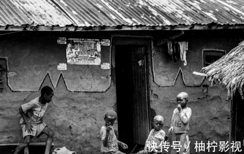 怀孕期间|宝宝生下来肤质不好,可能是因为这,孕妇应该注意了!